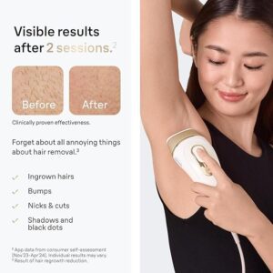 braun smart ipl